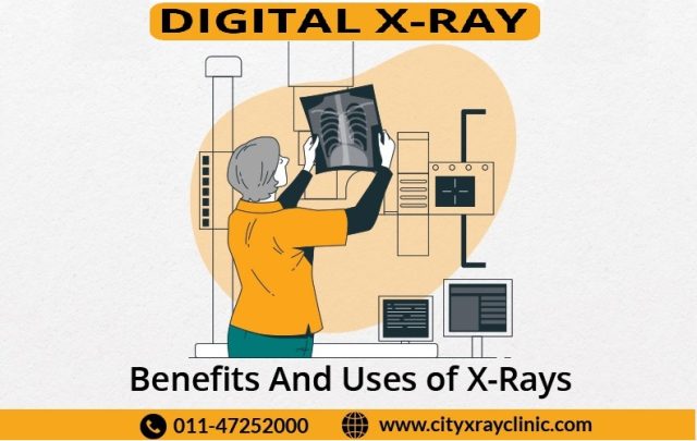Digital X Ray 1
